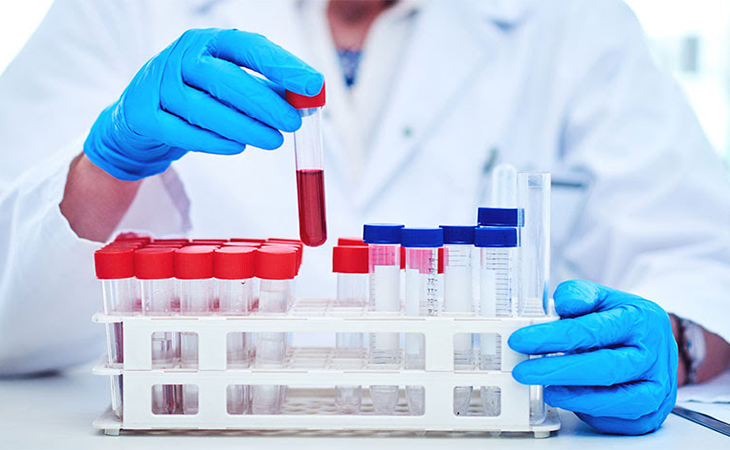 Understand Your Blood Markers In Depth